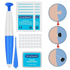 Skin Tag Remover Kit - Natural Safe Rubber Band Method