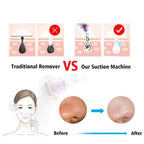 Blackhead Removal Suction Tool - Electric Pore Vacuum Cleaner