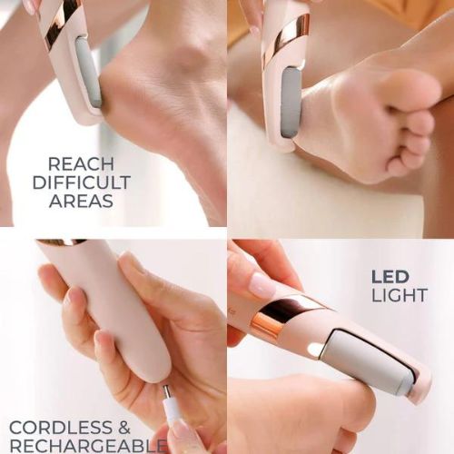 Electric Foot File - Rechargeable Callus Remover for Smooth Heels