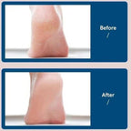 Electric Foot File - Rechargeable Callus Remover for Smooth Heels