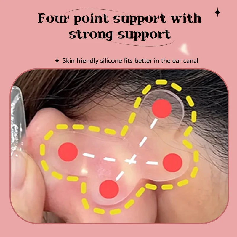 Discreet Ear Support Adhesive Patches - Waterproof & Hypoallergenic - TradixPro