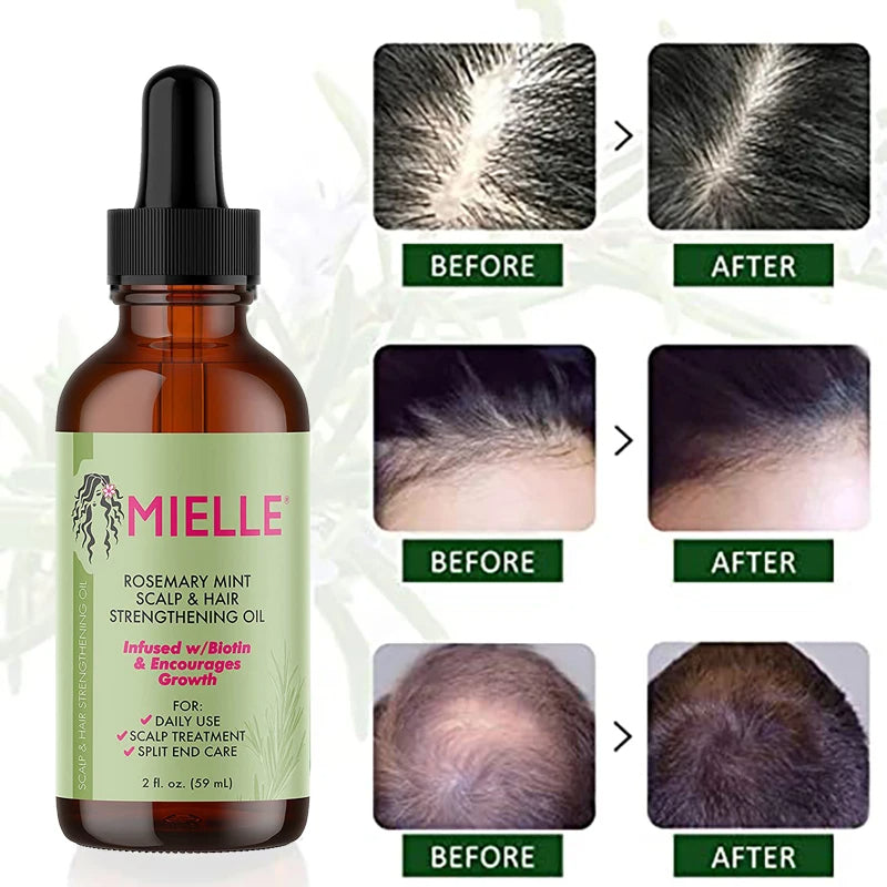 Natural Rosemary Hair Growth & Thickening Oil (Therapeutic Anti-Hair Loss Formula) - TradixPro
