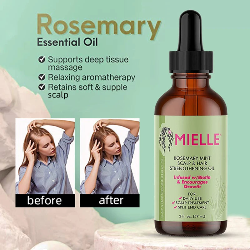 Natural Rosemary Hair Growth & Thickening Oil (Therapeutic Anti-Hair Loss Formula) - TradixPro