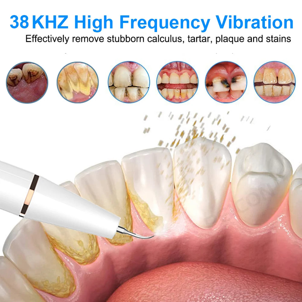 Professional Ultrasonic Tooth Cleaner & Plaque Remover - At-Home Deep Cleaning - TradixPro