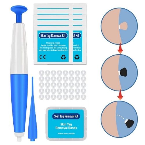 Skin Tag Remover Kit - Natural Safe Rubber Band Method - TradixPro